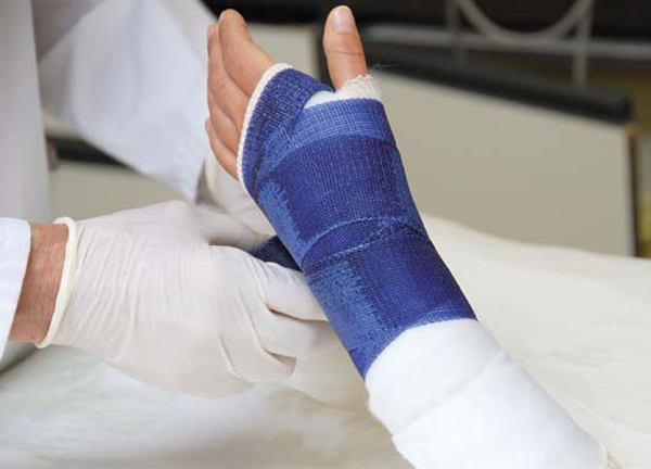 Bệnh Gãy xương bàn tay Nguyên nhân biến chứng và cách điều trị